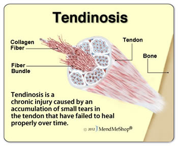 tendon primary midas civil